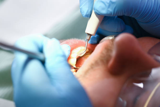Dentist for Dental Trauma in OR