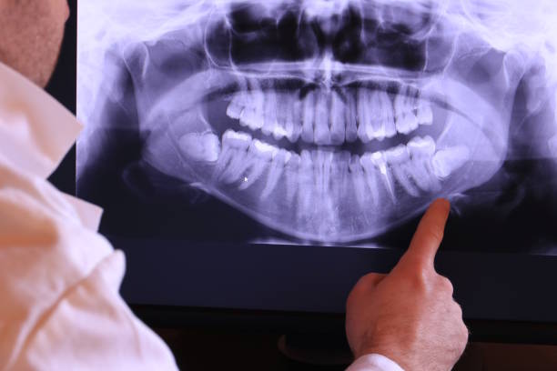 Emergency Gum Pain Relief in OR